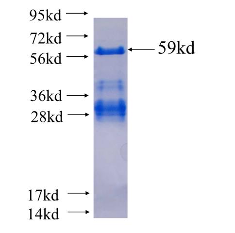 Recombinant human SMAD5 SDS-PAGE