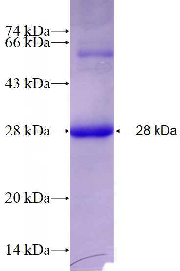 Recombinant Human MAD2L2 SDS-PAGE