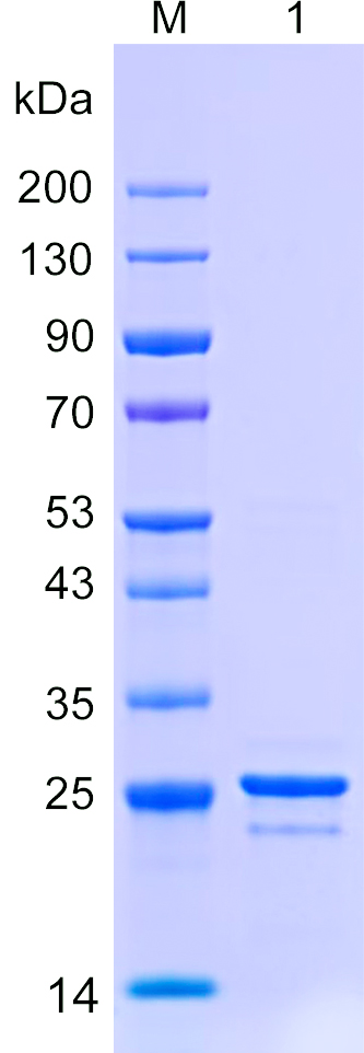 Recombinant XRCC4 protein (His tag) SDS-PAGE