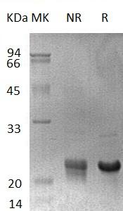 Human GADD45B/MYD118 (His tag) recombinant protein