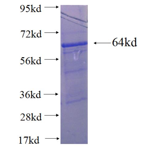 Recombinant human CREST SDS-PAGE