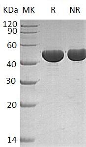 Human APOA4 (His tag) recombinant protein
