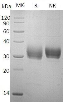 Human SOST/UNQ2976/PRO7455/PRO7476 (His tag) recombinant protein