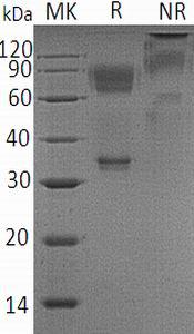 Human CD58/LFA3 (Fc tag) recombinant protein