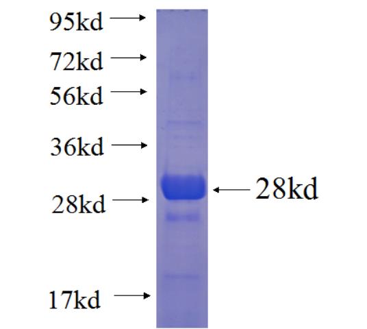 Recombinant human PLBD1 SDS-PAGE
