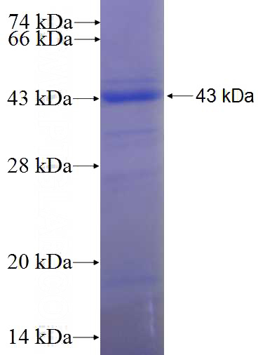 Recombinant Human UBLCP1 SDS-PAGE