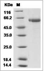 Influenza A H9N5 (A/shorebird/DE/261/2003) Hemagglutinin / HA Protein (His Tag)