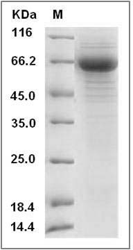 Influenza A H10N9 (A/duck/HongKong/562/1979) Hemagglutinin / HA Protein (His Tag) SDS-PAGE