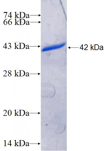 Recombinant Human NR2C2AP SDS-PAGE