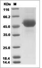 Influenza A H5N8 (A/breeder duck/Korea/Gochang1/2014) Hemagglutinin / HA1 Protein (His Tag)
