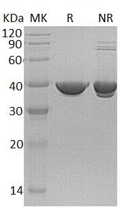 Human TALDO1/TAL/TALDO/TALDOR (His tag) recombinant protein