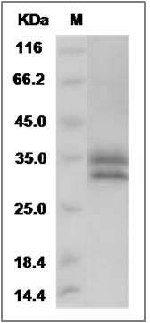 Human CFHR2 / FHR2 / HFL3 Protein (His Tag) SDS-PAGE
