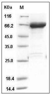 Human JNK1 / MAPK8 Protein (GST Tag) SDS-PAGE