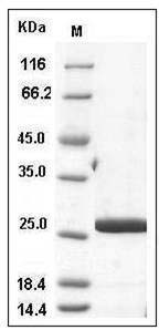 Human CRADD / RAIDD Protein (His Tag) SDS-PAGE