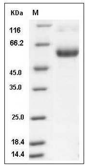 Mouse TNFR1 / CD120a / TNFRSF1A Protein (Fc Tag) SDS-PAGE