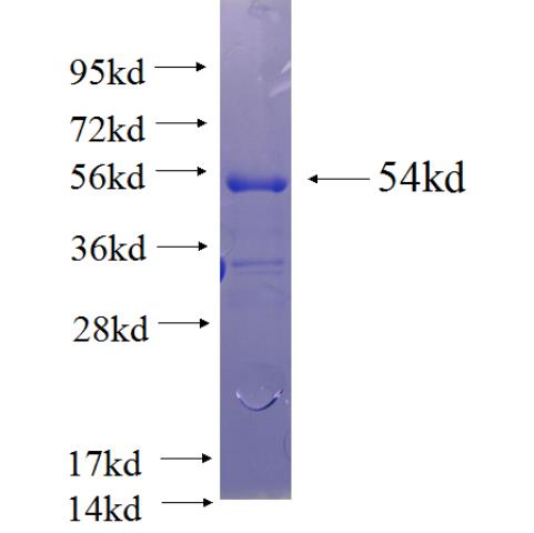 Recombinant human SCHIP1 SDS-PAGE