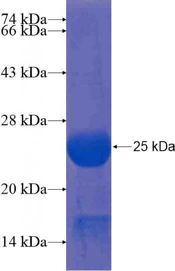 Recombinant Human C11orf31 SDS-PAGE