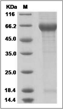 Human Nogo Receptor / NOGOR / RTN4R Protein (His Tag) SDS-PAGE