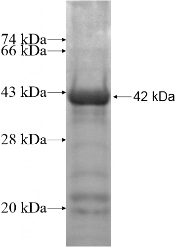 Recombinant Human ZKSCAN5 SDS-PAGE