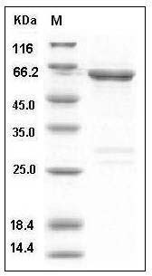 Human ACK1 / TNK2 Protein (GST Tag) SDS-PAGE