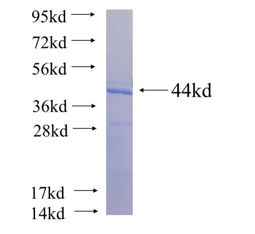 Recombinant human RBPJ SDS-PAGE