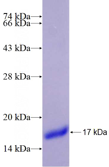 Recombinant Human HDAC9 SDS-PAGE