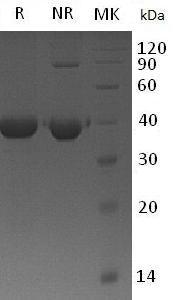 Mouse Pro-cathepsin H (His tag) recombinant protein
