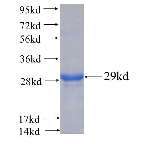 Recombinant human C1orf83(Full length) SDS-PAGE
