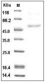 Human HAPLN1 Protein (His Tag) SDS-PAGE