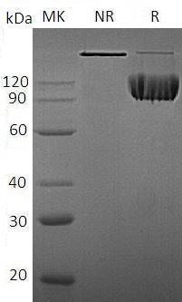 Human ALCAM/MEMD (Fc tag) recombinant protein