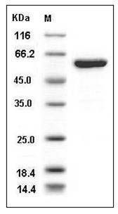 Human ALDH1A3 / RALDH3 Protein (His Tag) SDS-PAGE