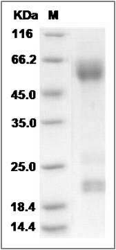 Rat ADAM17 Protein (His Tag) SDS-PAGE