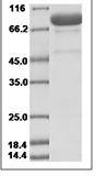 Human Fibroblast Activation Protein alpha/FAP Protein 15479