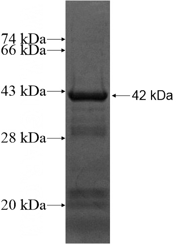 Recombinant Human PDXDC1 SDS-PAGE