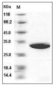 Human SULT1A1 / STP1 Protein (His Tag) SDS-PAGE