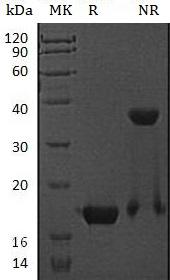 Mouse Cst7 (His tag) recombinant protein
