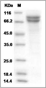Rat DSC2 / Desmocollin-2 Protein (His Tag) SDS-PAGE