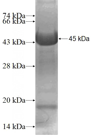 Recombinant Human C8A SDS-PAGE