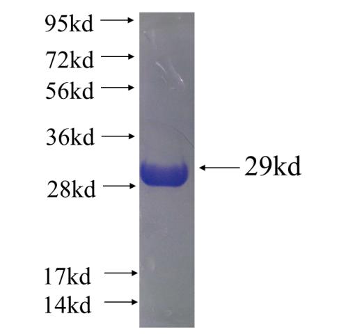 Recombinant human SNX1 SDS-PAGE