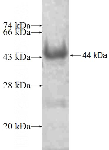 Recombinant Human EPHX1 SDS-PAGE