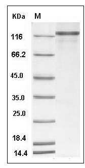 Human P63 / TP63 / Tumor protein p63 Protein (His & GST Tag) SDS-PAGE