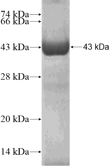 Recombinant Human CYP7B1 SDS-PAGE