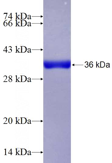 Recombinant Human DSC1 SDS-PAGE