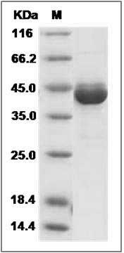 Human GCAP1 / GUCA1A Protein (His & GST Tag) SDS-PAGE