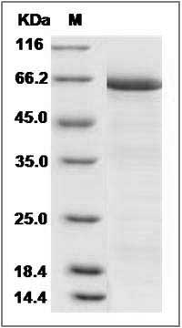 Human DCR3 / TNFRSF6B Protein (Fc Tag) SDS-PAGE