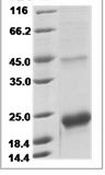 Human Prealbumin/Transthyretin Protein 15475