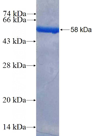 Recombinant Human DLX5 SDS-PAGE