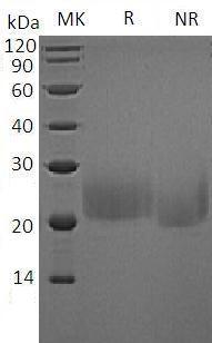 Mouse Ctla4/Cd152 (Flag tag) recombinant protein