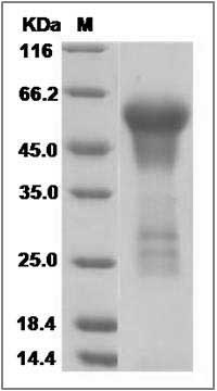 Human DRAXIN Protein (His Tag) SDS-PAGE