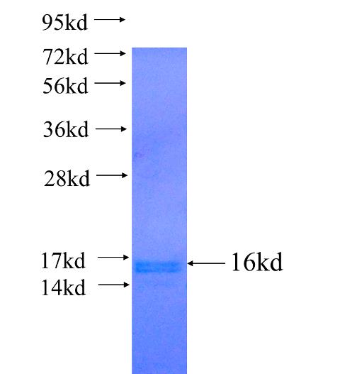Recombinant human HNRNPM SDS-PAGE